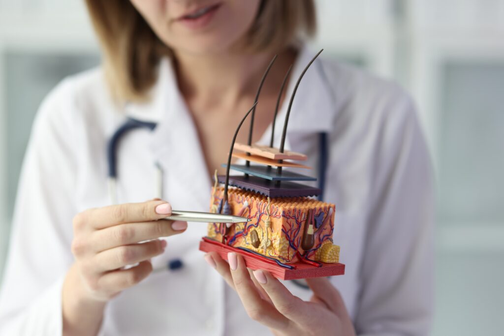 Dermatologist holding model of scalp and hair follicles.