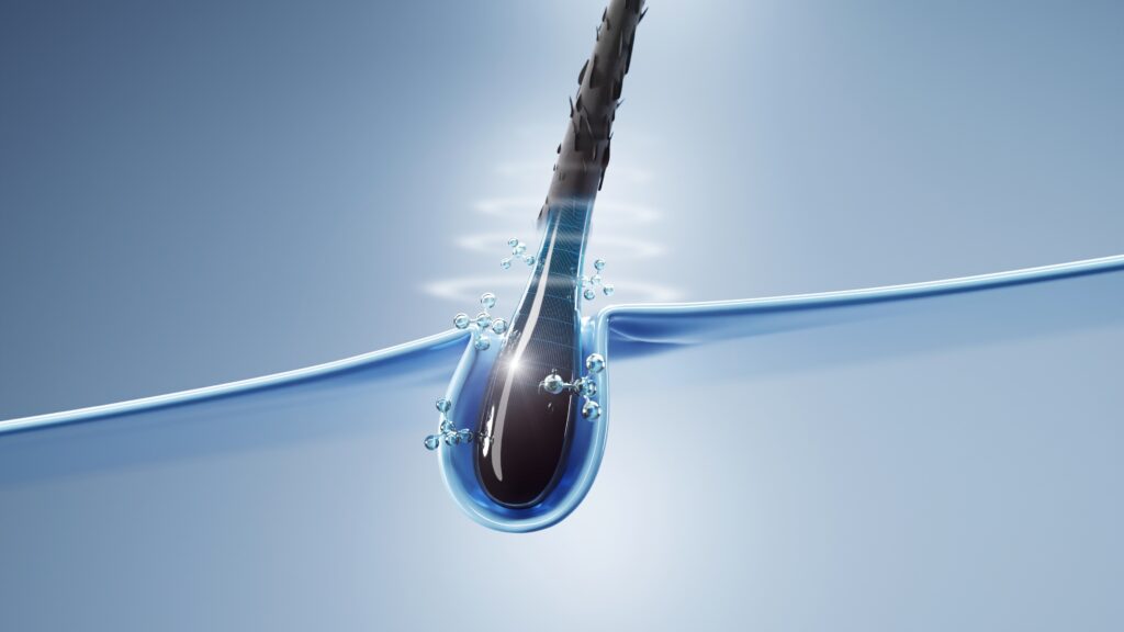 Nonsurgical hair treatment