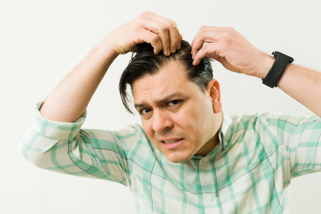 latin man concerned by hair loss examining his scalp with worried expression experiencing alopecia