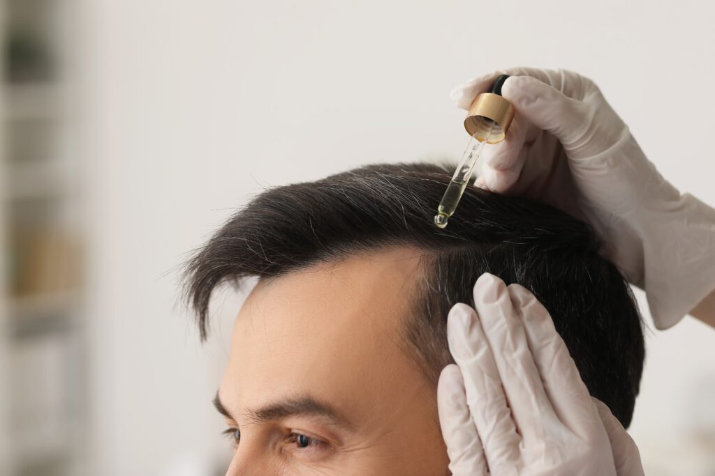 Doctor applying topical medication to hair and scalp.